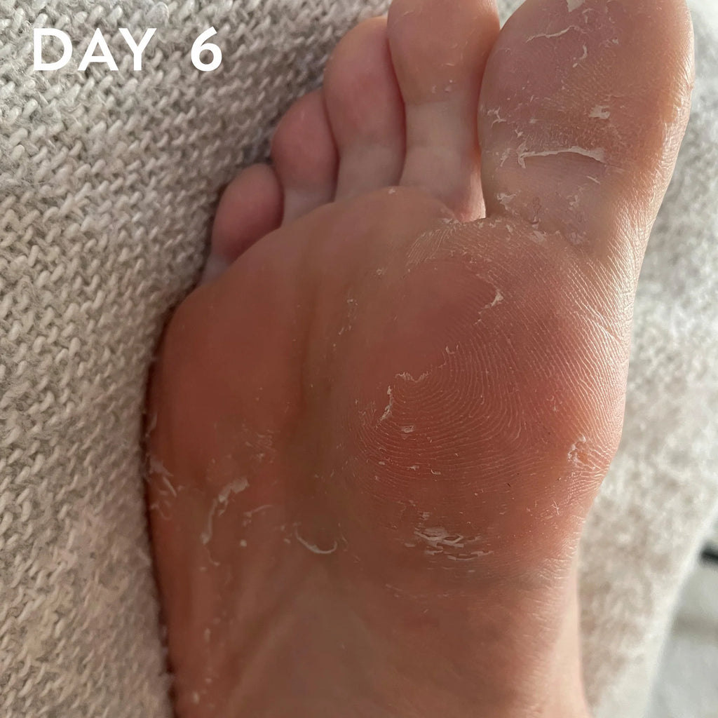 Beauty Pro Foot & Callus Peel Treatment Mask