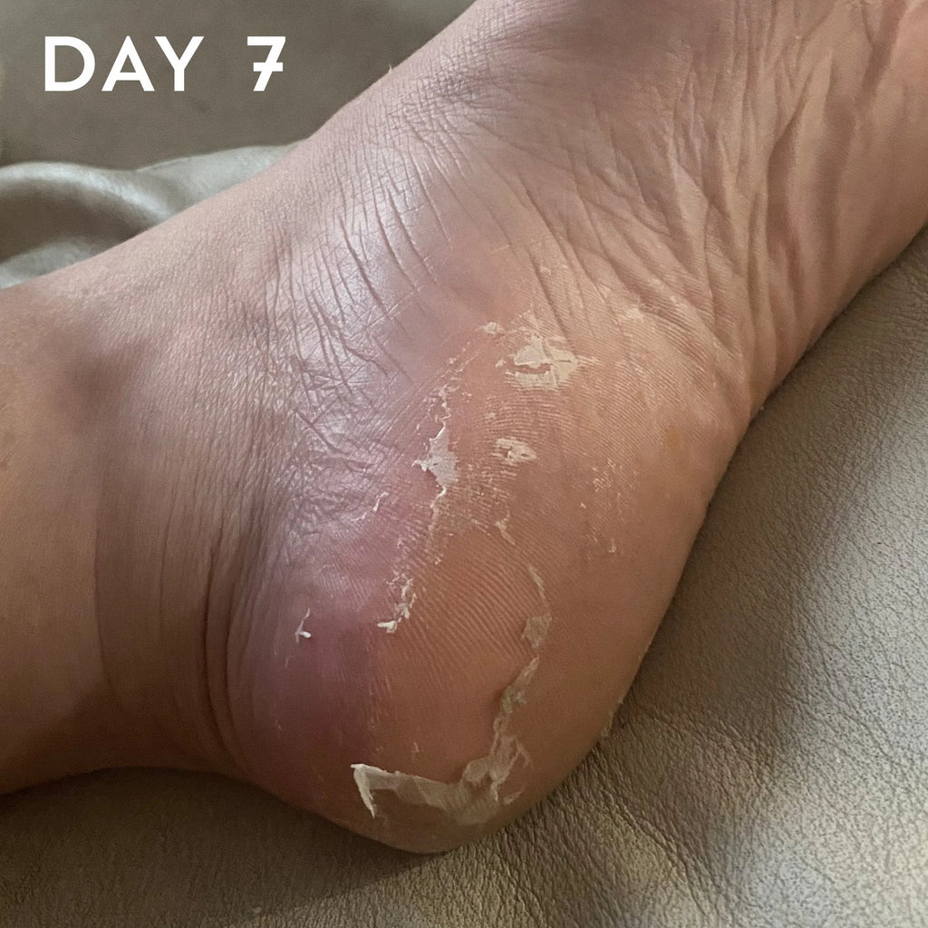 Beauty Pro Foot & Callus Peel Treatment Mask