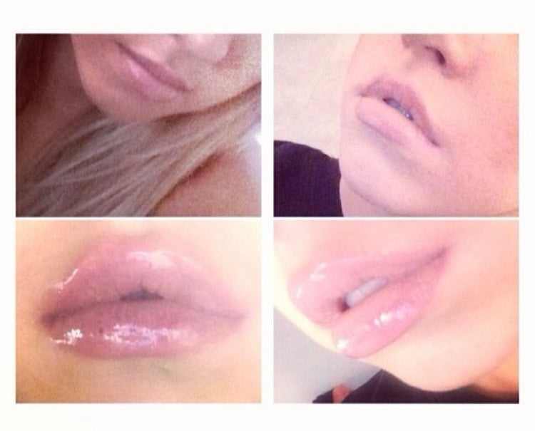 Dreamweave Lip Voltage Lip Plumper - Plumps Lips In Minutes - Official UK Online Stockist