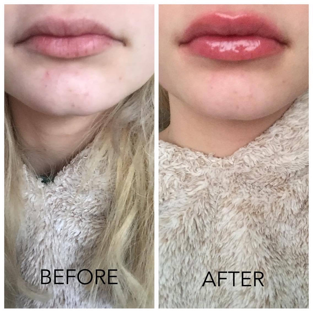 Dreamweave Lip Voltage Lip Plumper - Plumps Lips In Minutes - Official UK Online Stockist