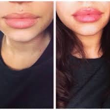 Dreamweave Lip Voltage Lip Plumper - Plumps Lips In Minutes - Official UK Online Stockist