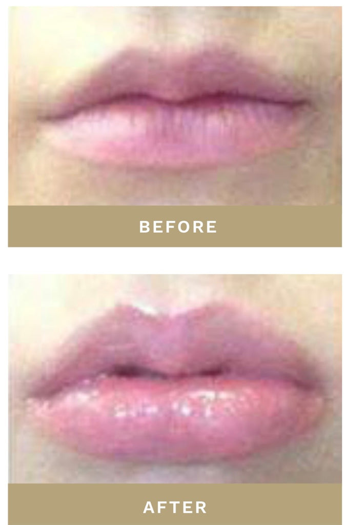 The Powerhouse Lip Plumper Before and After