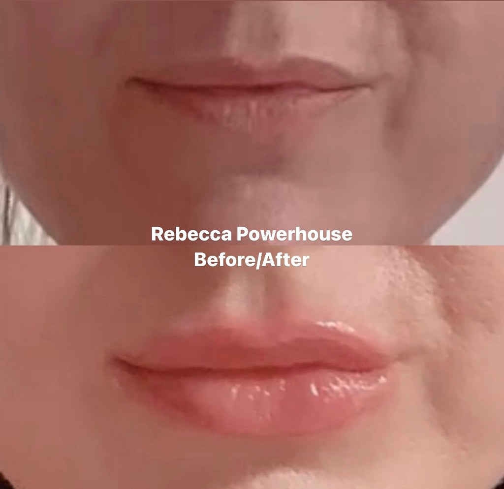 My results using The Powerhouse Lip Plumper. Dreamweave Lip Voltage
